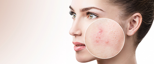 препарати 3